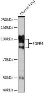 Anti-FGFR4 Rabbit Monoclonal Antibody [clone: ARC1474]