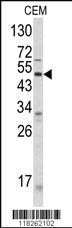 Anti-ANGPTL3 Rabbit Polyclonal Antibody