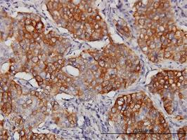 Anti-EIF4G3 Mouse Monoclonal Antibody [clone: 1H5]