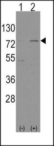 Anti-NFE2L2 Rabbit Polyclonal Antibody (Biotin)