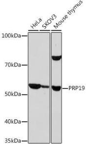 Western blot analysis of extracts of various cell lines, using Anti-PRP19 Antibody [ARC1685] (A305915) at 1:1,000 dilution. The secondary antibody was Goat Anti-Rabbit IgG H&L Antibody (HRP) at 1:10,000 dilution.