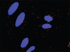 Anti-AKT1 + CDKN1A Antibody Pair