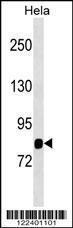 Anti-MASP1 Rabbit Polyclonal Antibody (AP (Alkaline Phosphatase))