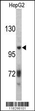 Anti-ITIH2 Rabbit Polyclonal Antibody