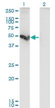 Anti-CTSE Mouse Monoclonal Antibody [clone: 2D5]