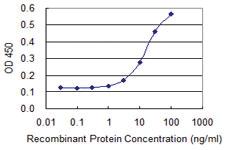 Anti-CTSE Mouse Monoclonal Antibody [clone: 2D5]