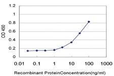 Anti-MED17 Mouse Monoclonal Antibody [clone: 1B5]