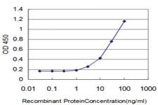 Anti-EIF4G3 Mouse Monoclonal Antibody [clone: 1H5]