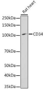 Western blot analysis of extracts of Rat heart, using Anti-CD34 Antibody (A11191) at 1:1,000 dilution. The secondary antibody was Goat Anti-Rabbit IgG H&L Antibody (HRP) at 1:10,000 dilution.