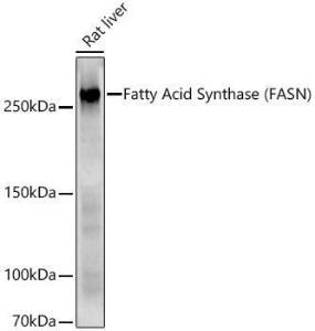 Western blot analysis of Rat liver, using Anti-Fatty Acid Synthase Antibody (A308729) at 1:1000 dilution