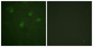 Immunofluorescence analysis of A549 cells using Anti-Estrogen Receptor-alpha Antibody. The right hand panel represents a negative control, where the antibody was pre-incubated with the immunising peptide