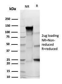 SDS-PAGE analysis of Anti-CD43 Antibody [rSPN/6563] under non-reduced and reduced conditions; showing intact IgG and intact heavy and light chains, respectively. SDS-PAGE analysis confirms the integrity and purity of the Antibody