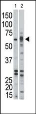 Anti-ACVR1B Rabbit Polyclonal Antibody