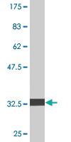 Anti-PIGS Mouse Monoclonal Antibody [clone: 3F3]