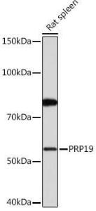 Western blot analysis of extracts of Rat spleen, using Anti-PRP19 Antibody [ARC1685] (A305915) at 1:1,000 dilution. The secondary antibody was Goat Anti-Rabbit IgG H&L Antibody (HRP) at 1:10,000 dilution.