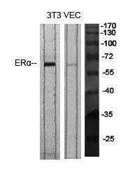 Western blot analysis of various cells using Anti-Estrogen Receptor-alpha Antibody