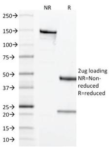 SDS-PAGE analysis of Anti-CD68 Antibody [LAMP4/1830] under non-reduced and reduced conditions; showing intact IgG and intact heavy and light chains, respectively SDS-PAGE analysis confirms the integrity and purity of the antibody