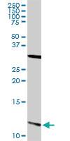 Anti-S100 A13 Rabbit Polyclonal Antibody