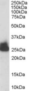 EB06643 staining (0.003µg/ml) of human liver lysate (RIPA buffer, 30µg total protein per lane). Primary incubated for 1 hour. Detected by western blot using chemiluminescence.