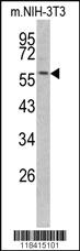 Anti-KRT14 Rabbit Polyclonal Antibody