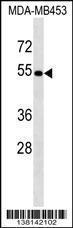 Anti-ACCS Rabbit Polyclonal Antibody (APC (Allophycocyanin))