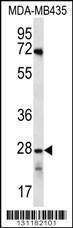 Anti-OR10AG1 Rabbit Polyclonal Antibody (Biotin)