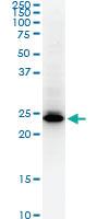 Anti-HMGB2 Mouse Monoclonal Antibody [clone: 3F2]