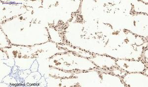 Immunohistochemical analysis of paraffin-embedded human lung tissue using Anti-Estrogen Receptor-alpha Antibody at 1:200 (4°C overnight). Negative control was secondary antibody only