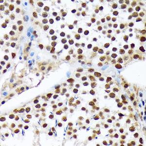 Immunohistochemistry analysis of paraffin-embedded rat testis using Anti-PRP19 Antibody [ARC1685] (A305915) at a dilution of 1:100 (40x lens). Perform microwave antigen retrieval with 10 mM Tris/EDTA buffer pH 9.0 before commencing with IHC staining protocol.