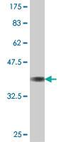 Anti-RPS6KA3 Mouse Polyclonal Antibody