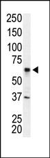 Anti-IRAK2 Rabbit Polyclonal Antibody