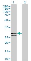 Anti-CTSG Rabbit Polyclonal Antibody