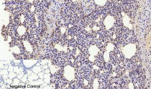 Immunohistochemical analysis of paraffin-embedded rat lung tissue using Anti-Estrogen Receptor-alpha Antibody at 1:200 (4°C overnight). Negative control was secondary antibody only