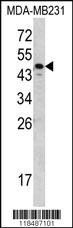 Anti-SERPINA7 Rabbit Polyclonal Antibody