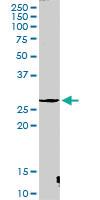 Anti-CTSG Rabbit Polyclonal Antibody