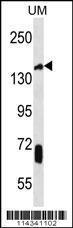 Anti-JHDM2a Rabbit Polyclonal Antibody (AP (Alkaline Phosphatase))