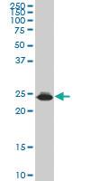 Anti-HMGB2 Mouse Monoclonal Antibody [clone: X1]