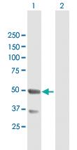 Anti-TNFRSF19 Mouse Polyclonal Antibody