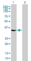 Anti-BIRC7 Mouse Polyclonal Antibody