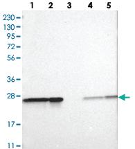 Anti-PSMA2 Rabbit Polyclonal Antibody