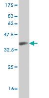 Anti-CCL14 Mouse Monoclonal Antibody [clone: 3B12]