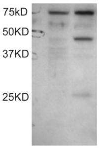 EB06656 staining (0.1 µg/ml) of COS1 cell lysates: untransfected (left lane) and transfected with full length recombinant Human DYX1C1 (right lane).  Data kindly provided by Wang and LoTurco, University of Connecticut, USA.