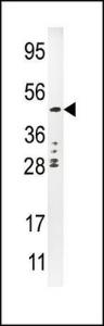 Anti-PLAU Rabbit Polyclonal Antibody (AP (Alkaline Phosphatase))