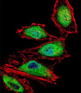 Anti-RUNX3 Rabbit Polyclonal Antibody