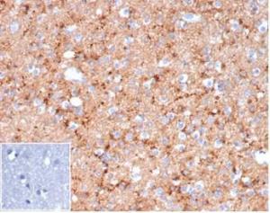 Immunohistochemical analysis of formalin-fixed, paraffin-embedded human brain tissue using Anti-Synaptophysin Antibody [rSYP/6856] at 2µg/ml. Inset: PBS instead of the primary antibody. Secondary antibody negative control.