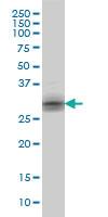 Anti-KLK8 Mouse Monoclonal Antibody [clone: 2F11]