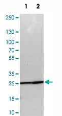 Anti-PSMA2 Rabbit Polyclonal Antibody