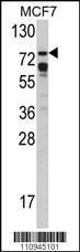 Anti-BRAF Rabbit Polyclonal Antibody (PE (Phycoerythrin))