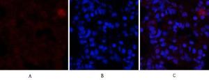 Immunofluorescence analysis of rat lung tissue using Anti-Estrogen Receptor-alpha Antibody (red) at 1:200 (4°C overnight). Cy3 labelled secondary antibody was used at 1:300 (RT 50min). Panel A: Target. Panel B: DAPI. Panel C: Merge