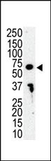 Anti-IRAK3 Rabbit Polyclonal Antibody